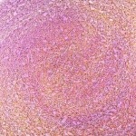 HRS16 - PINKISH DELIGHT